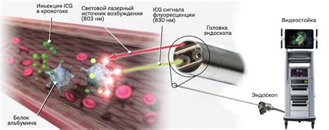 Флуоресцентная гидродизомия